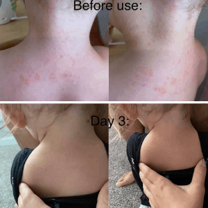 MIG ritual body lotion bar before and after of girl's neck